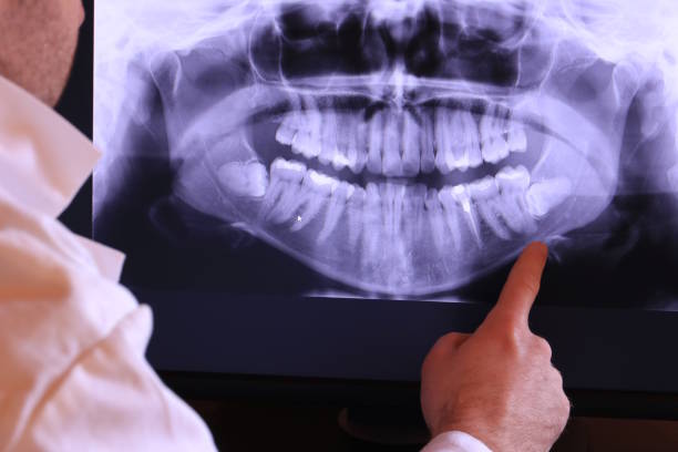 Best Broken Tooth Emergency  in Ladera, CA